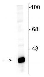 DARPP-32 Polyclonal Antibody