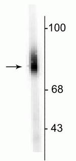 Dopamine beta Hydroxylase Polyclonal Antibody