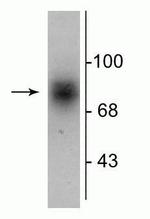 Dopamine Transporter Polyclonal Antibody
