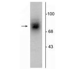 Dopamine Transporter Polyclonal Antibody