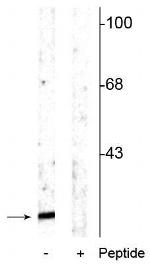 Phospho-alpha Synuclein (Ser129) Polyclonal Antibody