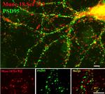 Phospho-MUNC18 (Ser515) Polyclonal Antibody