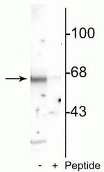 Phospho-MUNC18 (Ser515) Antibody in Western Blot (WB)