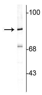 RPH3A Polyclonal Antibody