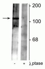Phospho-GABBR2 (Ser783) Antibody in Western Blot (WB)