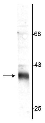 Stargazin Polyclonal Antibody