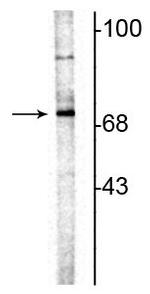 ChAT Polyclonal Antibody