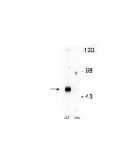 GABRA2 Polyclonal Antibody