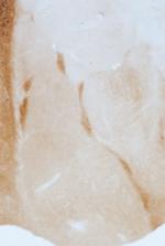 GABRA3 Polyclonal Antibody