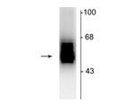 GABRB2 Polyclonal Antibody