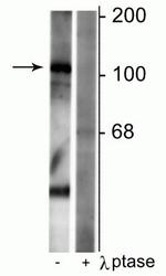 Phospho-GABBR1 (Ser923) Polyclonal Antibody