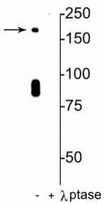 Phospho-NMDAR2B (Ser1480) Polyclonal Antibody
