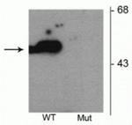 Phospho-Parkin (Ser101) Polyclonal Antibody