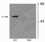 Phospho-Parkin (Ser378) Polyclonal Antibody