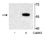 Phospho-TPH2 (Ser19) Polyclonal Antibody