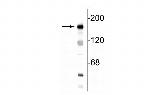 NMDAR2B Polyclonal Antibody