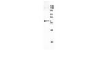 recA Antibody in Immunoprecipitation (IP)
