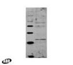 GCN5 Antibody in Western Blot (WB)