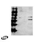 HIV1 Reverse Transcriptase Antibody in Western Blot (WB)