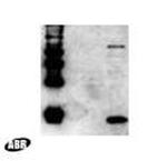 HIV1 p17 Antibody in Western Blot (WB)