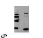 HIV1 p17 Antibody in Western Blot (WB)