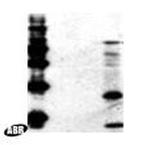 HIV1 p55 Antibody in Western Blot (WB)