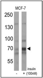Phospho-p70 S6 Kinase (Thr389) Antibody in Western Blot (WB)