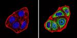 PKC alpha Antibody in Immunocytochemistry (ICC/IF)