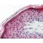Aurora B Antibody in Immunohistochemistry (Paraffin) (IHC (P))