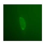 Emerin Antibody in Immunocytochemistry (ICC/IF)