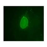 Emerin Antibody in Immunocytochemistry (ICC/IF)