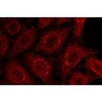 gp210 Antibody in Immunocytochemistry (ICC/IF)