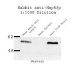 NUP53 Antibody in Western Blot (WB)