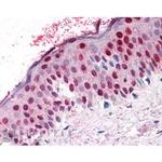 RANGAP1 Antibody in Immunohistochemistry (Paraffin) (IHC (P))