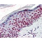 RCC1 Antibody in Immunohistochemistry (Paraffin) (IHC (P))