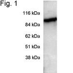 PDE6A Polyclonal Antibody
