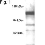 PDE6A Antibody in Western Blot (WB)