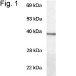 GNAT1 Polyclonal Antibody