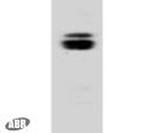 CNGB1 Antibody in Western Blot (WB)