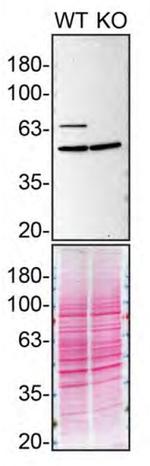 MUNC18 Antibody in Western Blot (WB)