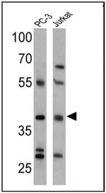 CNR2 Polyclonal Antibody