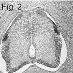 Cannabinoid Receptor 1 Antibody in Immunohistochemistry (IHC)