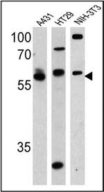 Cannabinoid Receptor 1 Antibody in Western Blot (WB)