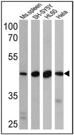 BACE2 Antibody in Western Blot (WB)