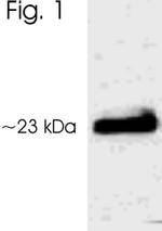 Phospho-AANAT (Thr29) Polyclonal Antibody