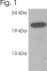 RAB3c Antibody in Western Blot (WB)