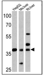 FOXA3 Polyclonal Antibody