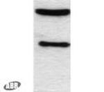 C/EBP alpha Polyclonal Antibody