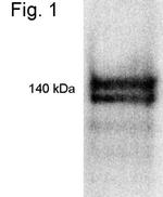 RIP140 Antibody in Western Blot (WB)