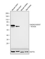 GAD65/GAD67 Polyclonal Antibody